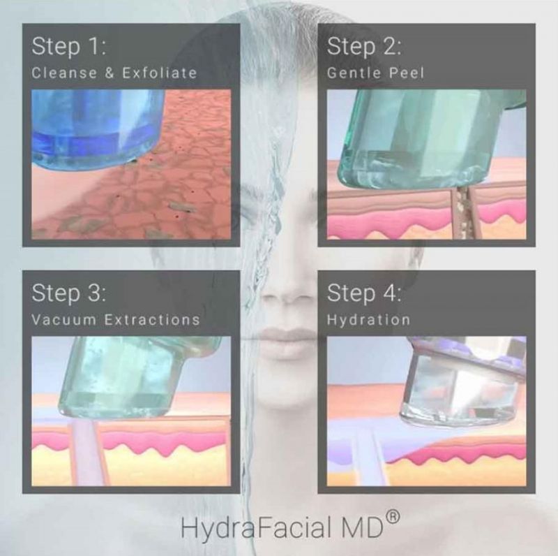 Hydra Facial System Dermabrasions9 in 1 Machine