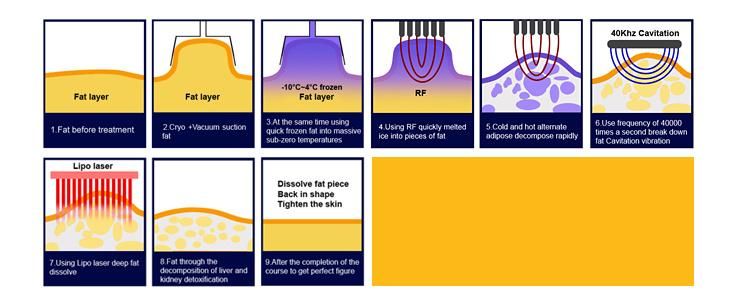 Weight Loss Cavitation RF Cryolipolysis Lipo Laser Slimming Machine