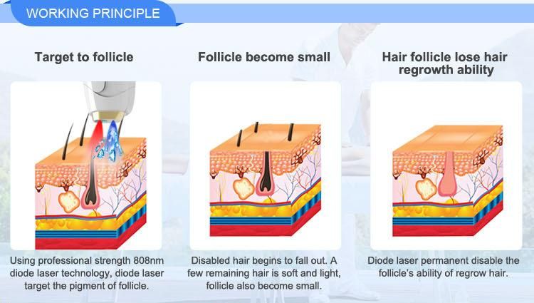 Portable Diode Laser Hair Removal 3 Wave 808 755 1064