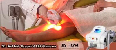 Apolo Best Hair Removal and Vascular Removal Elight IPL Beauty Equipment