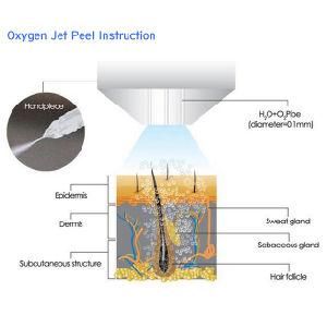 Water Dermabrasion Facial Aqua Peel (WD10)