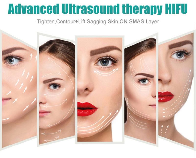 Vertical Vso-019A Hifu Machine 7D Ultraformer Hifu Beauty Face Lifting Device Equipment