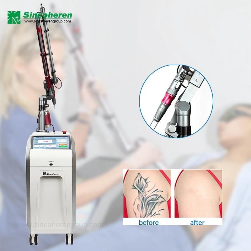 Q-Switched Laser Tattoo Removal Machine/1064nm 532nm Laser Machine with Medical CE Approved Pigmentation Treatment