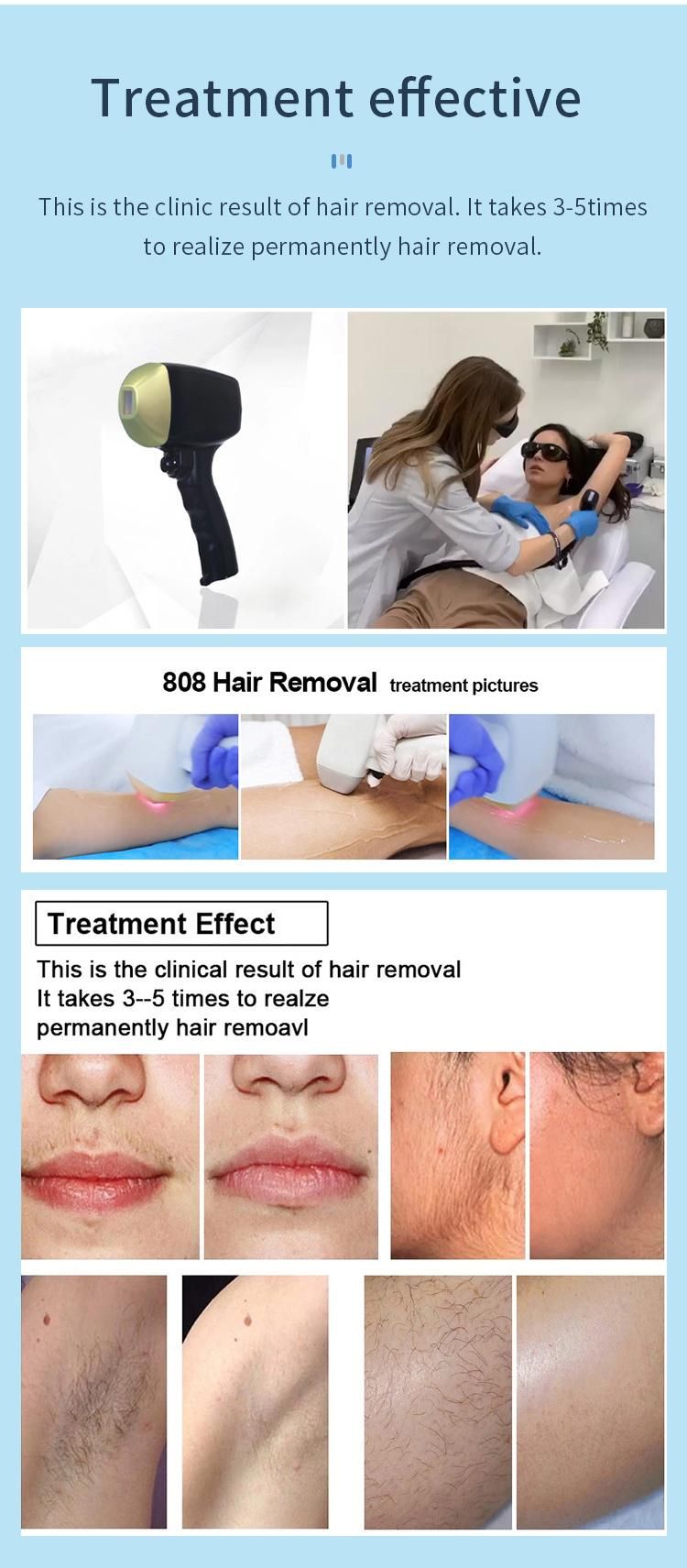 Painless 755/808/1064nm Permanence Hair Removal Beauty Equipment