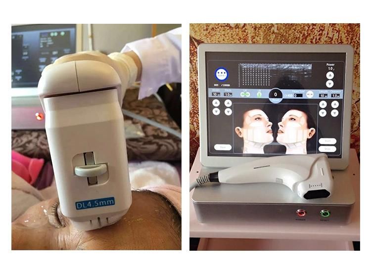 2D Anti Aging Wrinkle Face Lift Machine