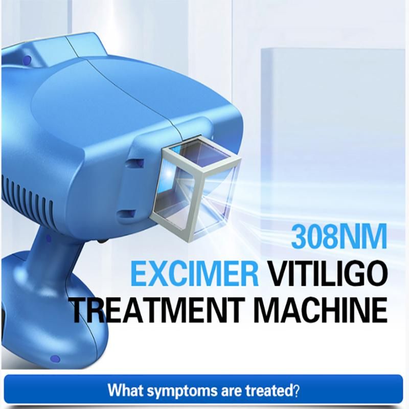 308nm Excimer Laser Vitiligo Phototherapy Instrument Genuine Home Medical UVB UV Treatment Instrument 308 Excimer Laser Vitiligo
