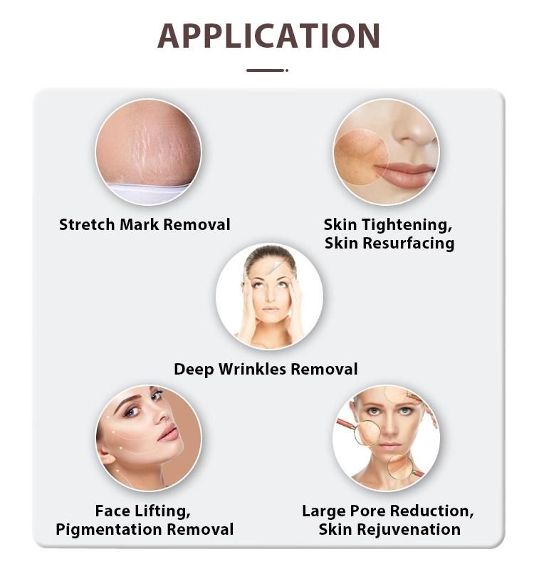 Sanhe Microneedle Acne Wrinkle Stretch Marks Removal Treatment