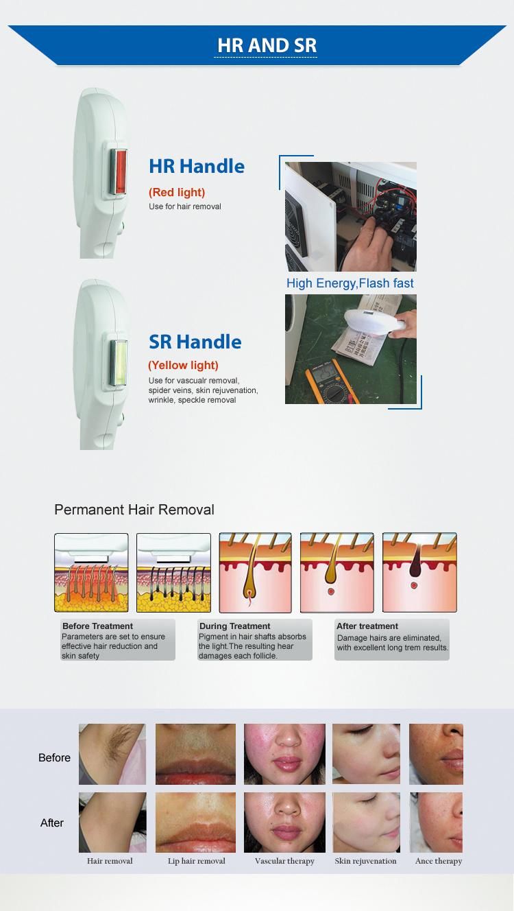 Vertical 2 Handles IPL Shr Permanent Hair Removal Machine Factory Price