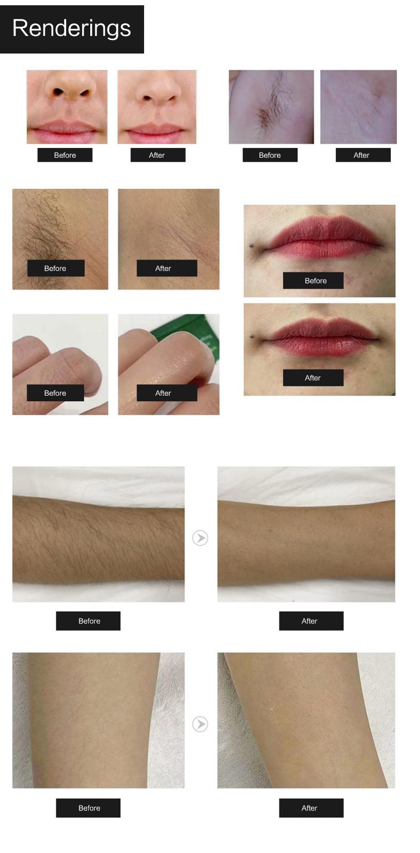 New Professional Beauty Machine 3 Wavelength Laser Equipment Laser Hair Removal Machine