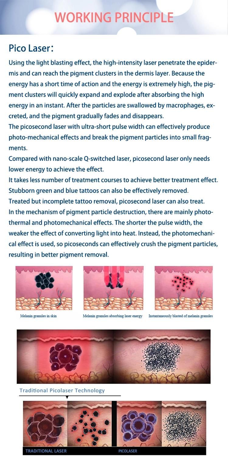 Picosecond Laser for Freckles Loss with 808nm Permanent Hair Loss Salon Super Picosecond Pl-86