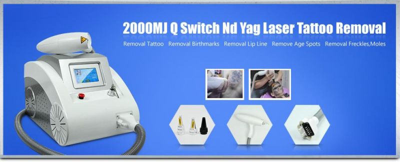 Imported Ruby Laser Korea Q Switch ND YAG Laser Tattoo Removal Machine with Ce