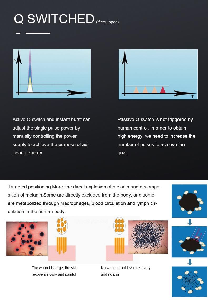 Most Advanced Beauty Equipment Pigment Removal Tattoo Removal Q-Switched ND YAG Laser