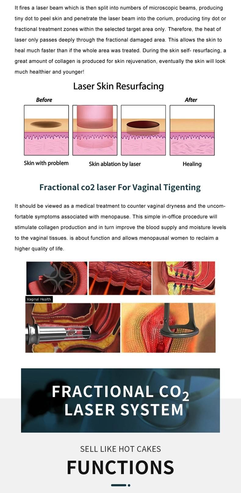 Best Fractional CO2 Laser Vaginal Tightening Machine