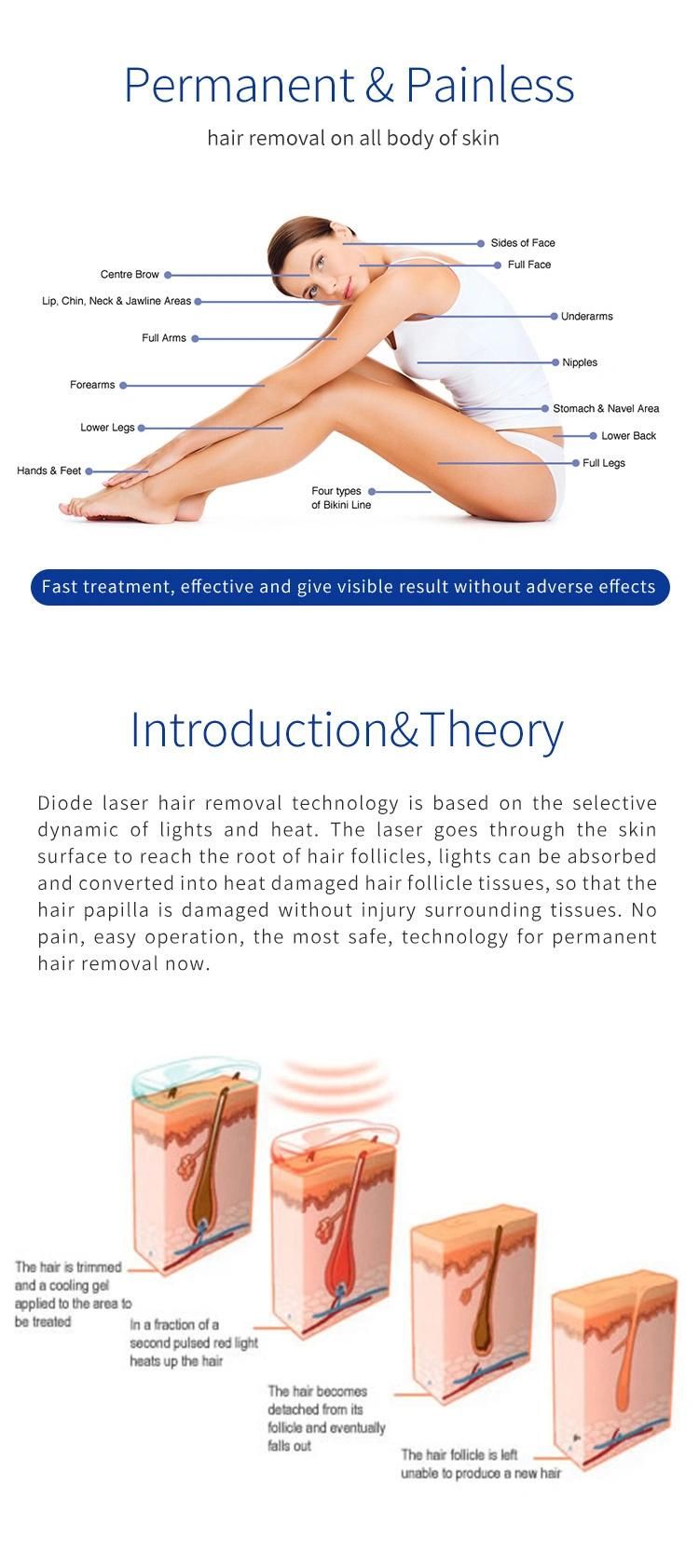 3 Wavelength Hair Removal 808nm Diode Laser Alexandrite Laser Equipment