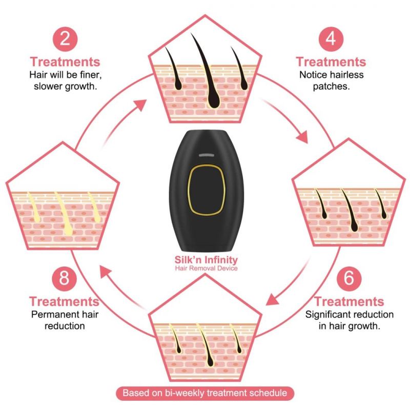 Painless IPL Hair Removal with 500000 Flashes