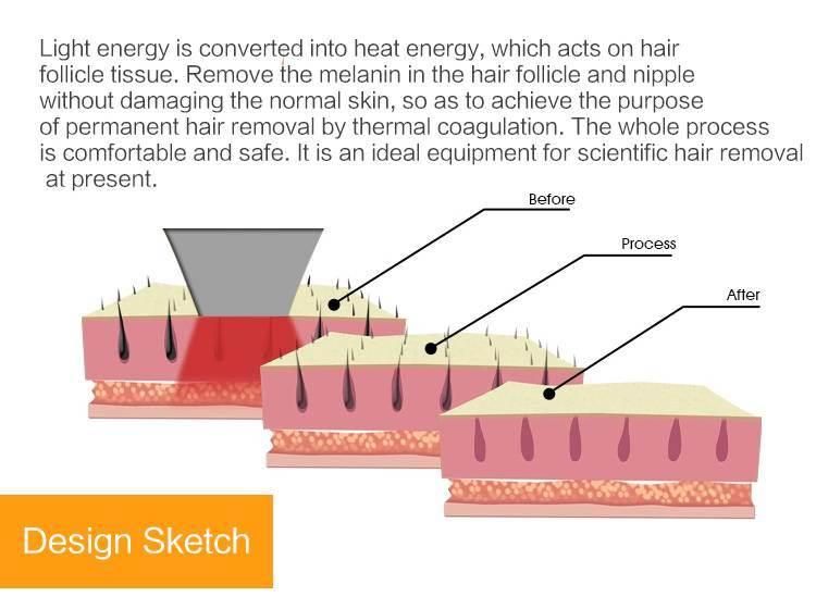 Permanent Beauty Machine Diode Laser Hair Removal Machine All Skin Types and Hair Types