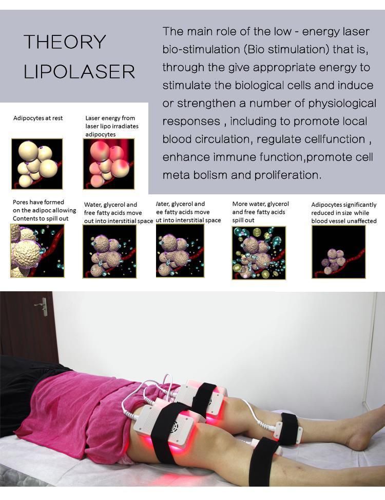 Laser Diode Lipolaser Machine Body Slimming Machine for Body Shaping