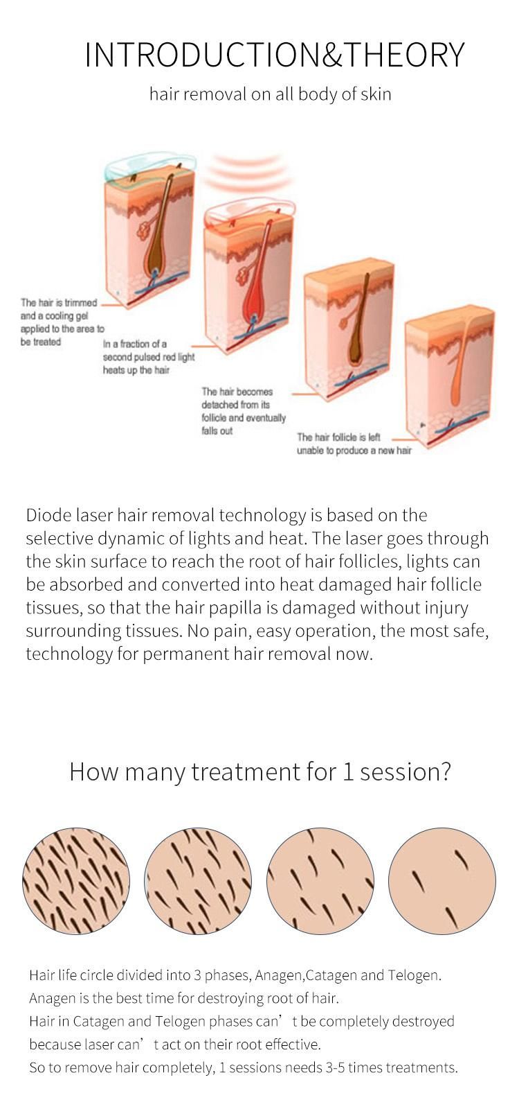 Manufacturer 808nm Diode Hair Removal Permanently Laser Machine Price