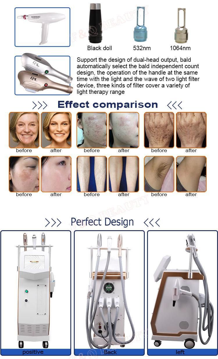 Salon Equipment 4 in 1 Multi-Function Dpl RF Lifting ND YAG Laser Hair Removal Skin Rejuvenation Tattoo Removal Beauty Equipment
