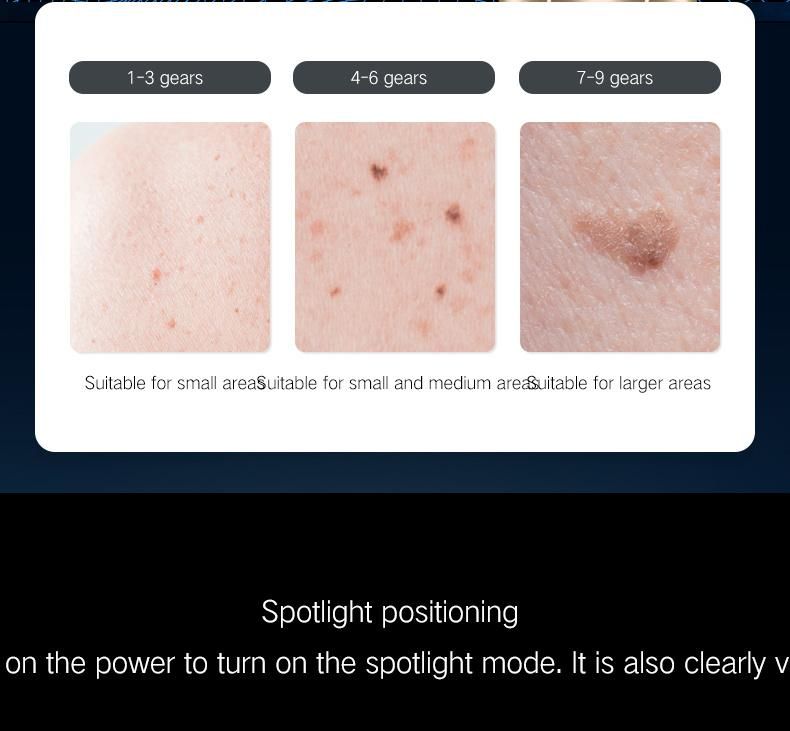 3 in 1 Blue Light Micro Portable Handhold Mole Skin Moles Speckles Dark Instant Spots Removes Laser Pen