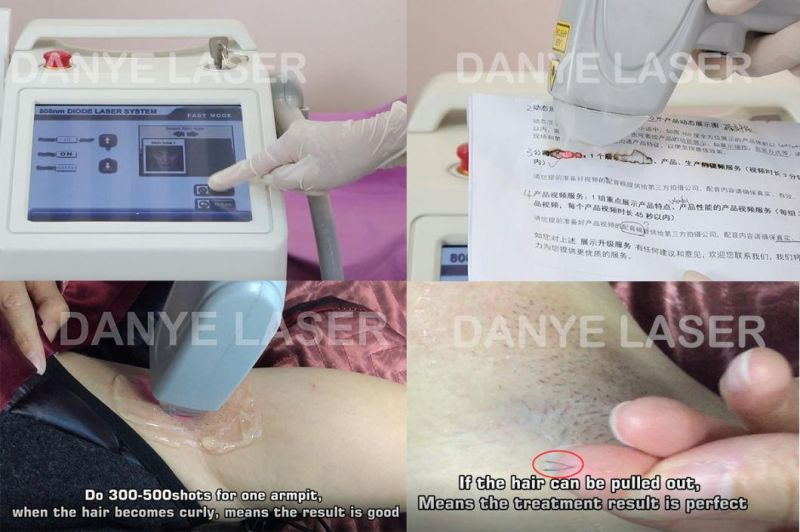 808nm Professional Soprano Device Beauty Equipment Diode Laser Hair Removal