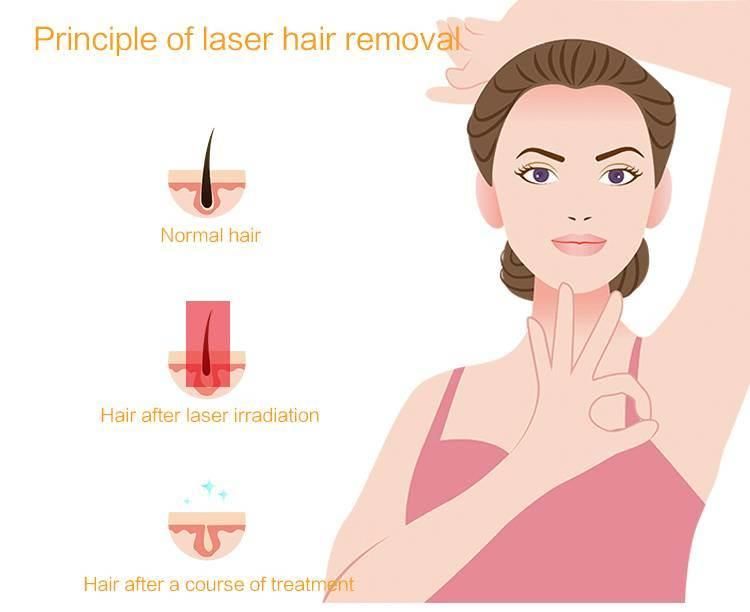 Best Sale Laser Equipment High Efficiency 3 Waves Beauty Machine Diode Laser Hair Removal Machine