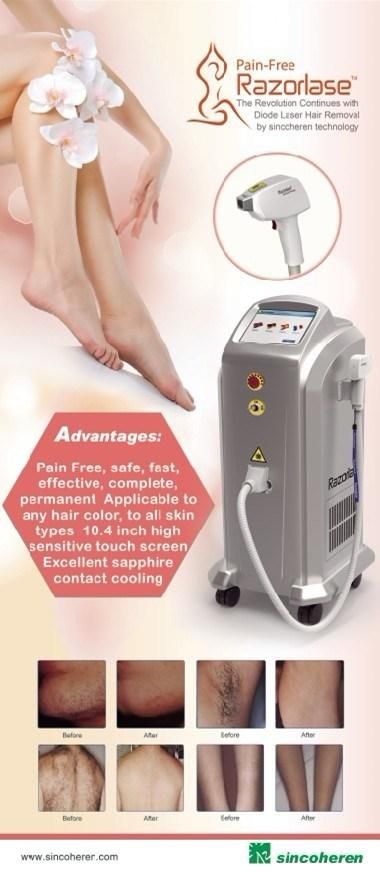 2018 New Factory Price Clinically Proven Effective 808nm Diode Laser Hair Removal Machine