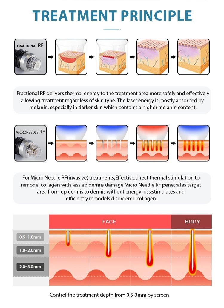 Skin Tightening Fractional RF Microneedle RF Wrinkles Removal
