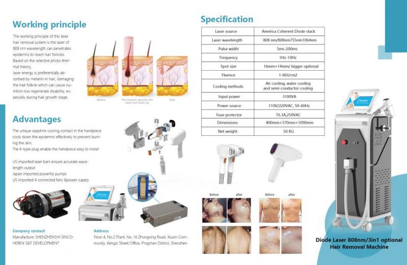 Permanent Hair Loss Vertical 808nm Diode Laser Hair Removal Laser Diode with CE