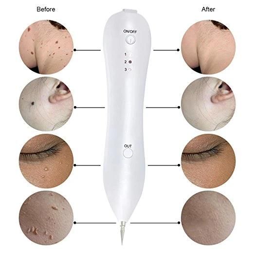 Beauty Laser Spot Removal Plasma Pen for Skin Care