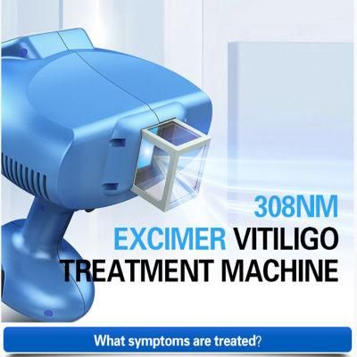 Vitiligo Treatment Skin Care Equipment UVB Lamp Handy Cure Laser Machine Vitiligo Light Therapy