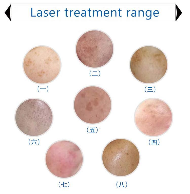 Laser / RF / IPL Multisystem Vertical Beauty Machine for Sale