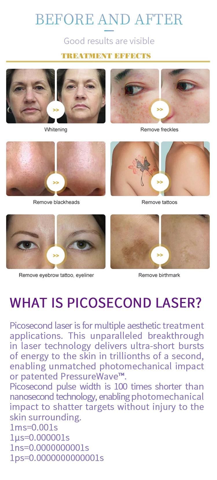 755nm Laser Tattoo Removal Picosecond Q Switched ND YAG Laser