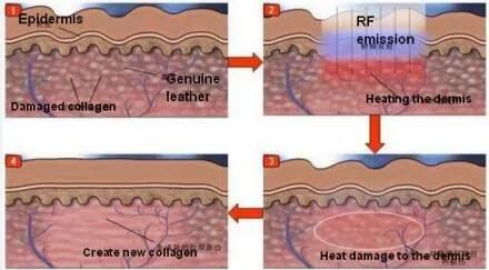 Hf-904 Cavitation & RF Slimming Weight Lose System