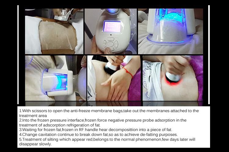 Factory Price! Fat Freezing Cryolipolysis Beauty Machine for Weight Loss