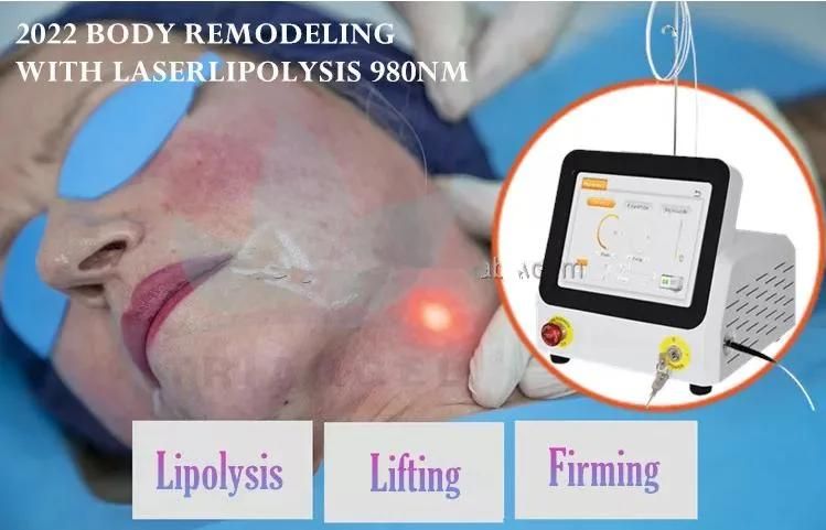 Endolift 1470nm Laser for Face Lifting Diode Laser 1470nm Lipolisis Liposuction Laser Endolift