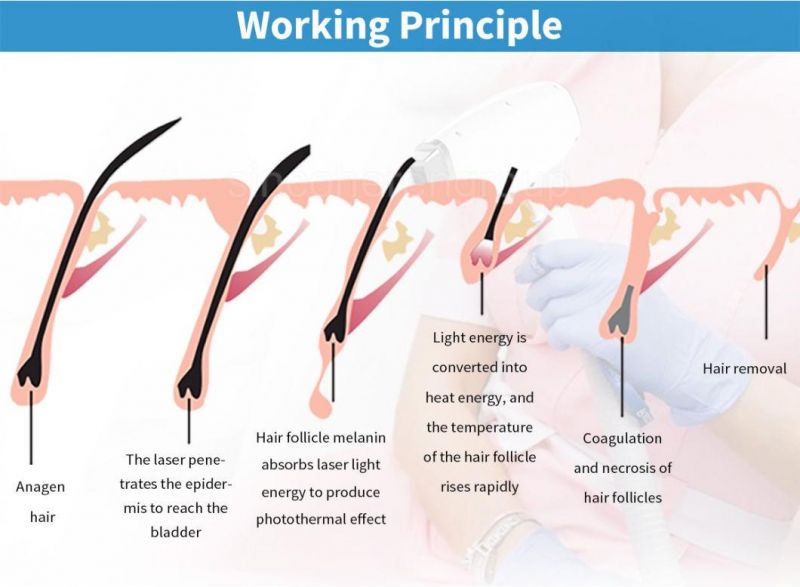 China Sincoheren Best Factory Price FDA Approved No Pain 808nm Effective Diode Laser Hair Removal