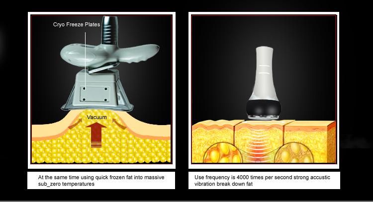 Factory Price! Fat Freezing Cryolipolysis Beauty Machine for Weight Loss