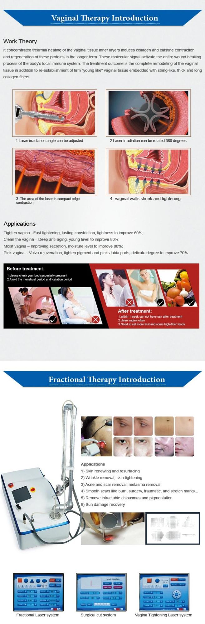 Professional 10600nm Fractional CO2 Vaginal Rejuvenation Laser Device