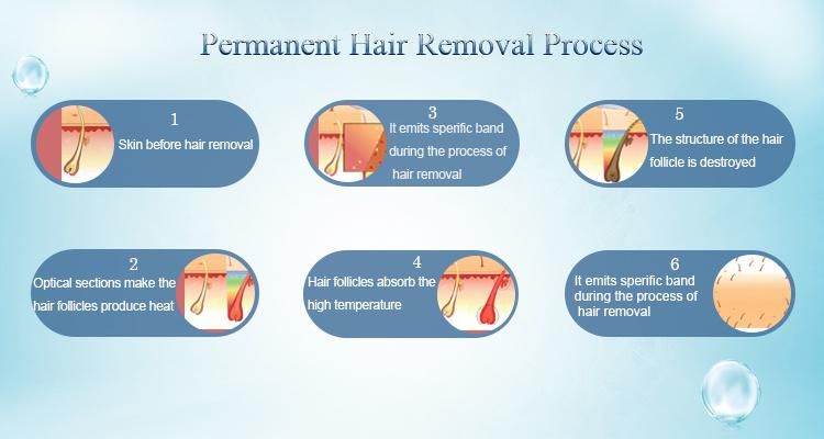 Permanent Hair Loss Vertical 808nm Diode Laser Hair Removal Laser Diode with CE