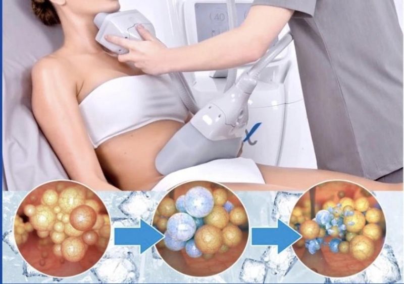 CE Approved 360 Degree Coolplas Fat Freezing Cellulite Removal Machine