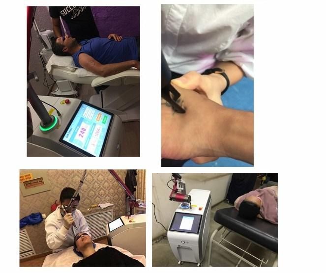 FDA Approved Erbium YAG Laser Distribudor Price Magic Plus Laser