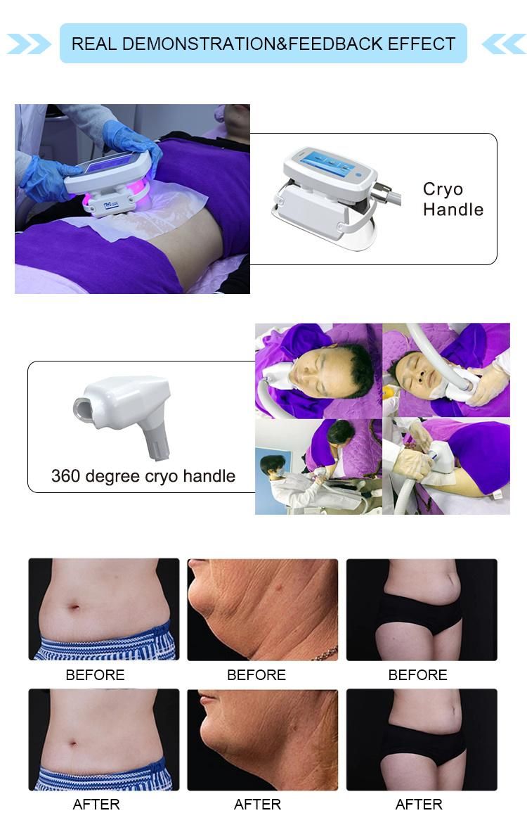 20211 Newest Cryolipolysis Beauty Machine Cool Slimming Beauty Equipment Fat Freezing