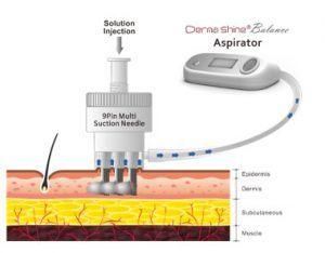 Derma Shine Balance PRO 9pin Korea Mesotherapy Mesogun Injector Antibiotic Injection