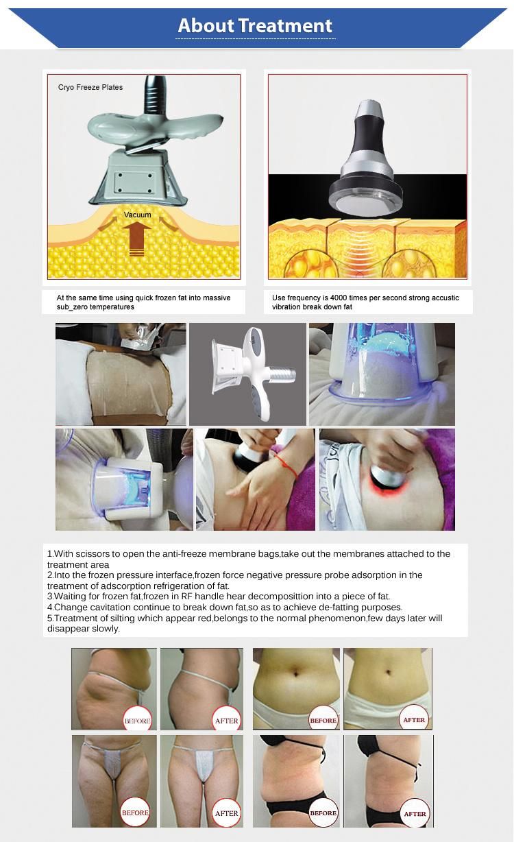 4 Cryo Handles Cryolipolysis Fat Freezing Slimming Machine / Best Cavitation Ultrasonic Beauty Salon Equipment
