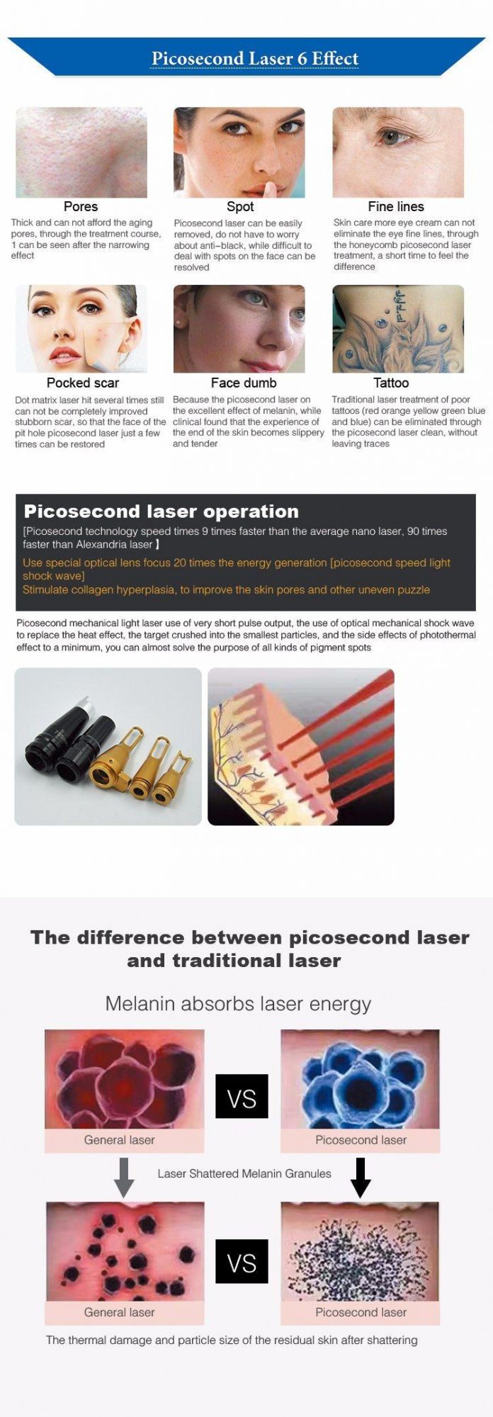 Powerful Picosecond Laser Tattoo Removal 1064nm