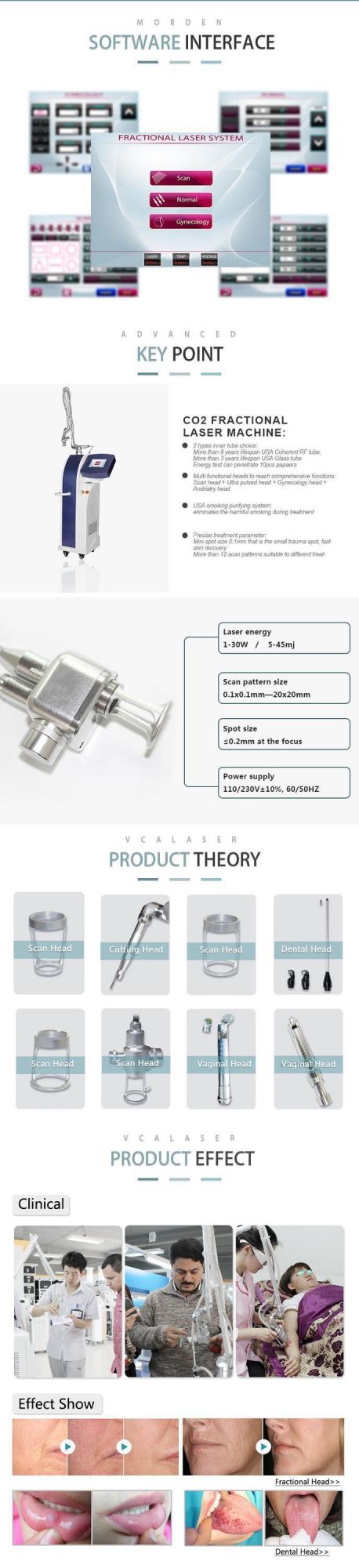 The Original Spot Size Is Highly Consistent Fractional CO2 Laser Scar Removal Equipment