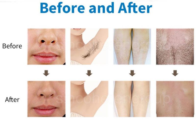 Portable Desktop Effective Laser Hair Removal Permanent Face Hair Skin Rejuvenation Beauty Device Diode Laser