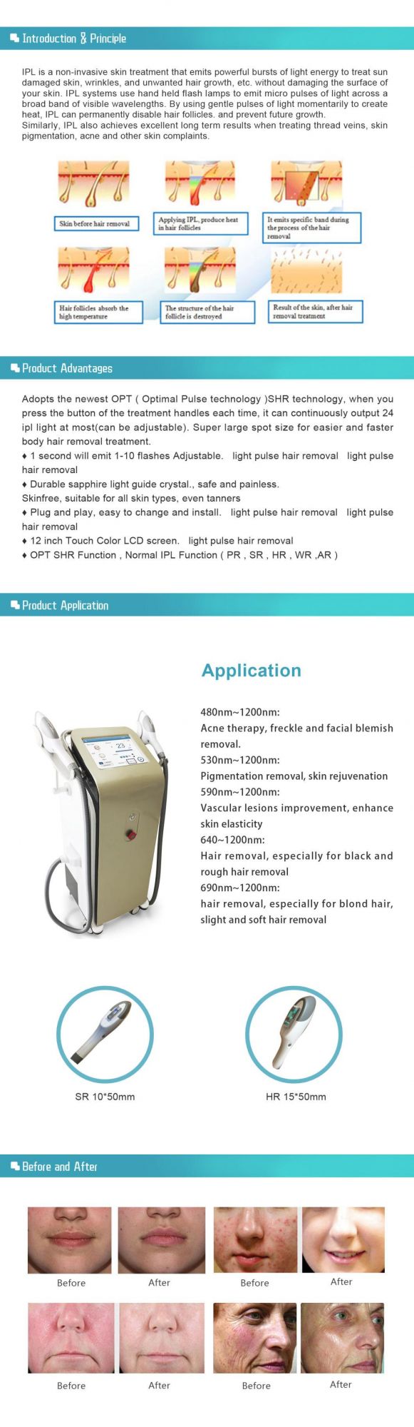 Best Selling Opt+IPL+E-Light Hair Removal Skin Care Salon Beauty Machine