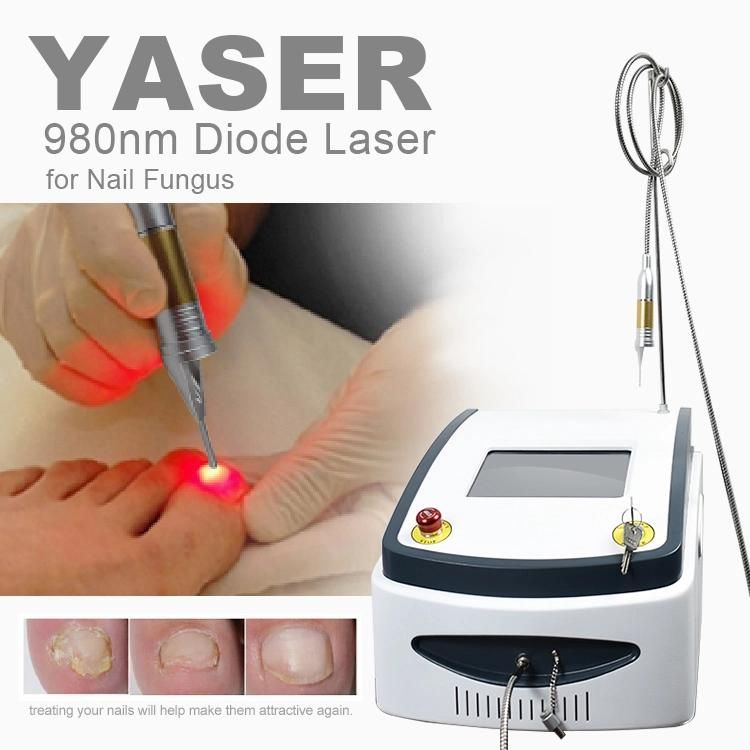 Nail Fungus Removal 980nm Diode Laser Machine
